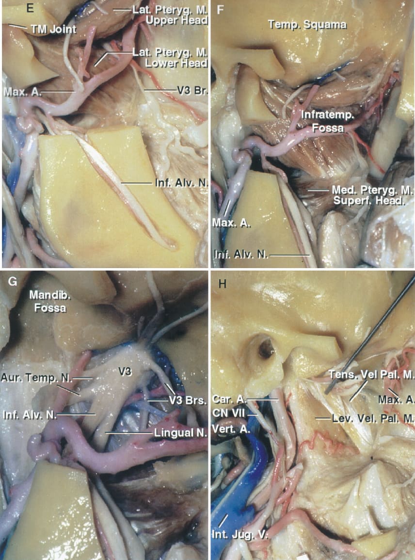 Anatomic Basis of the Postauricular Transtemporal Approach ...