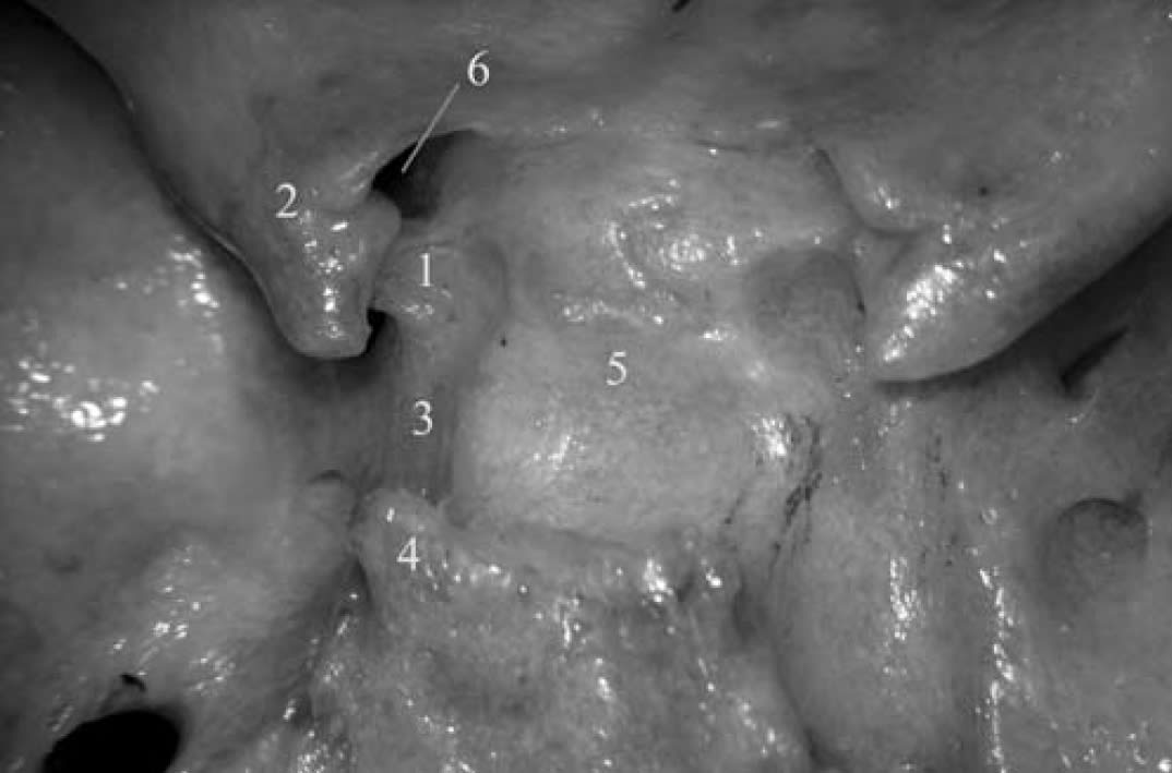 Anatomical View of the Paraclinoid Region | Neuroanatomy | The ...