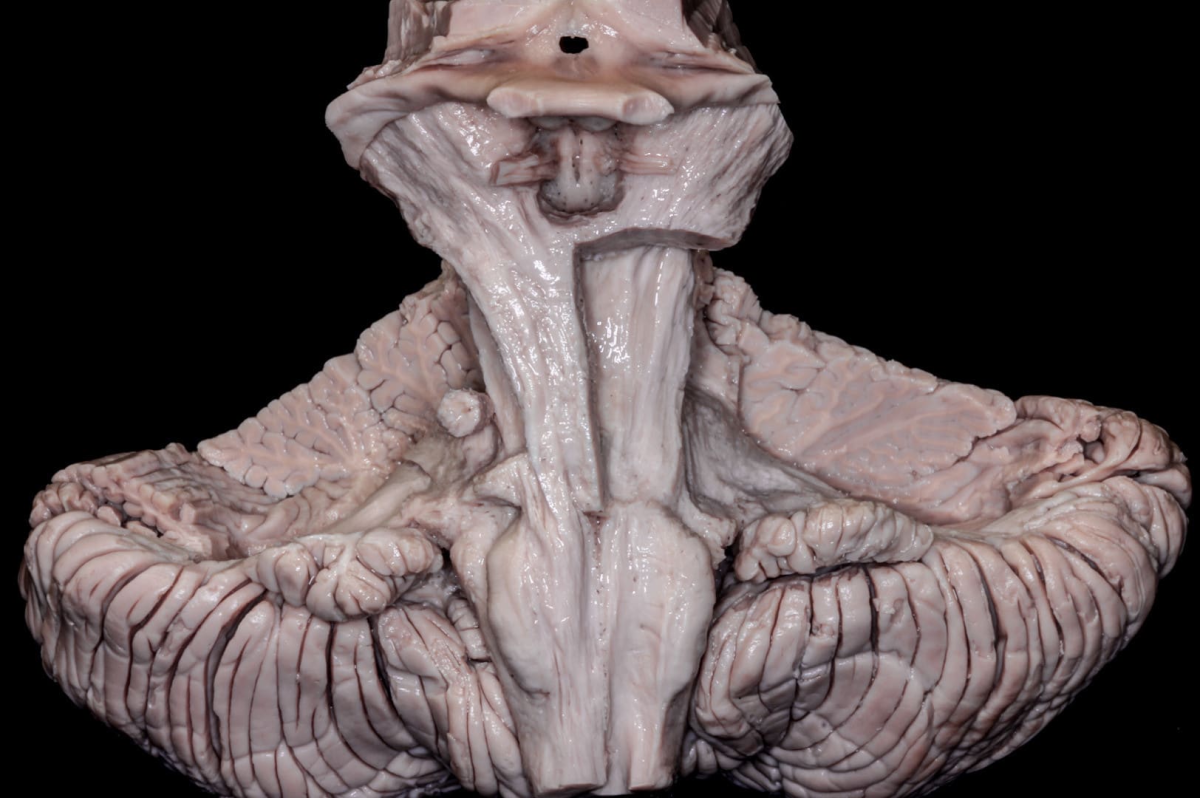 Anterior View of the Brainstem and Cerebellum with Longitudinal Fiber ...
