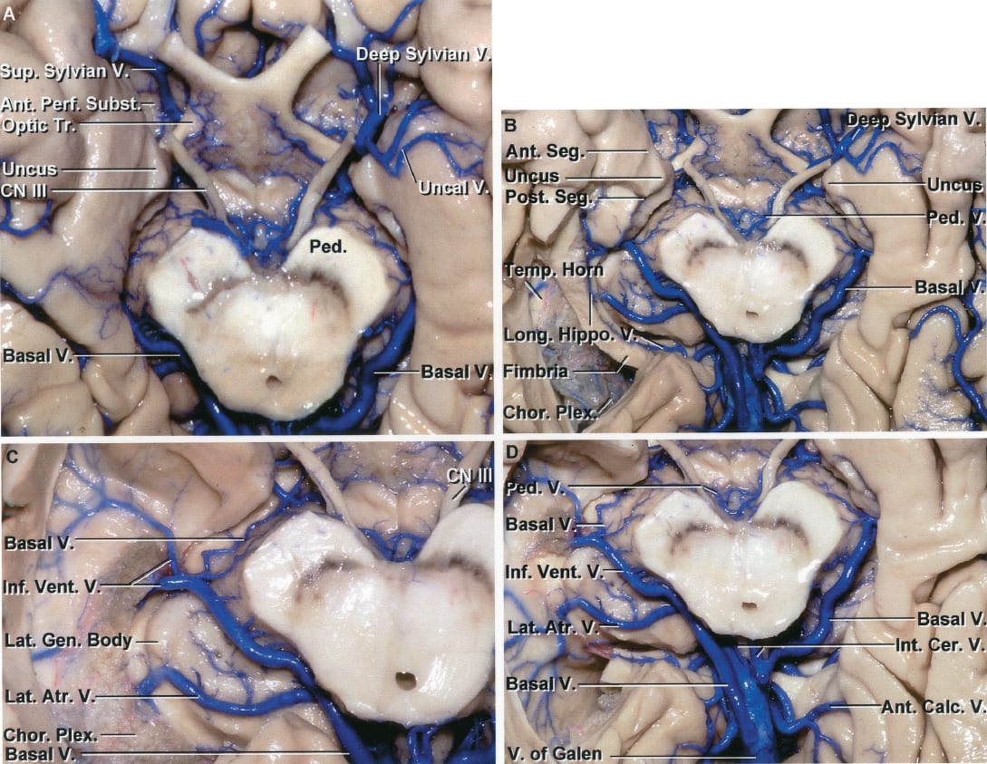 Inferior View of the Basal Cisterns | Neuroanatomy | The Neurosurgical ...