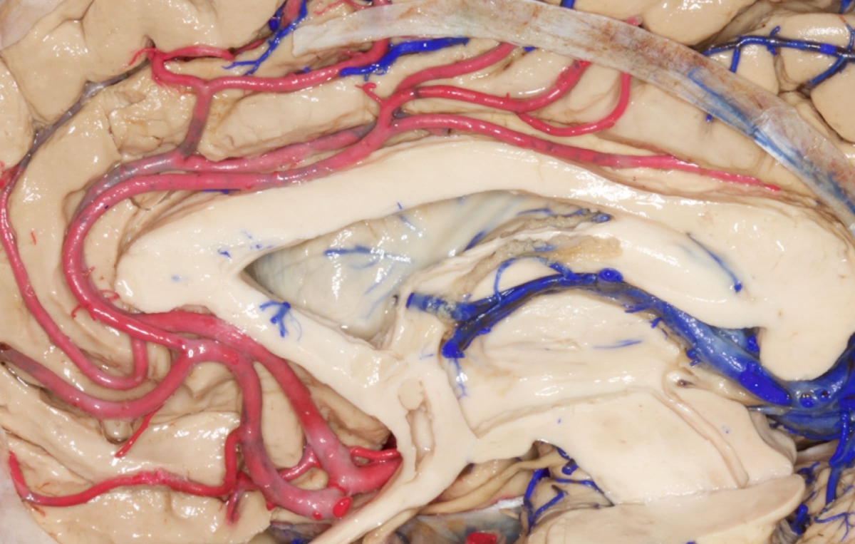 Medial View of Right Hemisphere | Neuroanatomy | The Neurosurgical Atlas