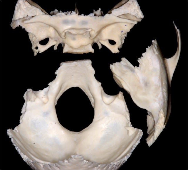 Osseous Anatomy of the Posterior Skull Base | Neuroanatomy | The