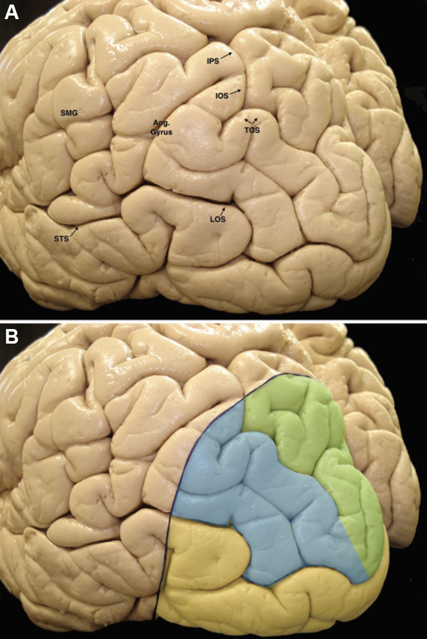 Posterolateral View of the Left Hemisphere | Neuroanatomy | The ...