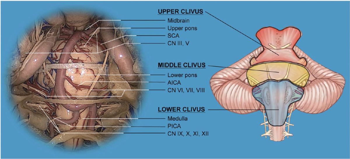 relationship-between-each-division-of-the-clivus-and-the-neurovascular