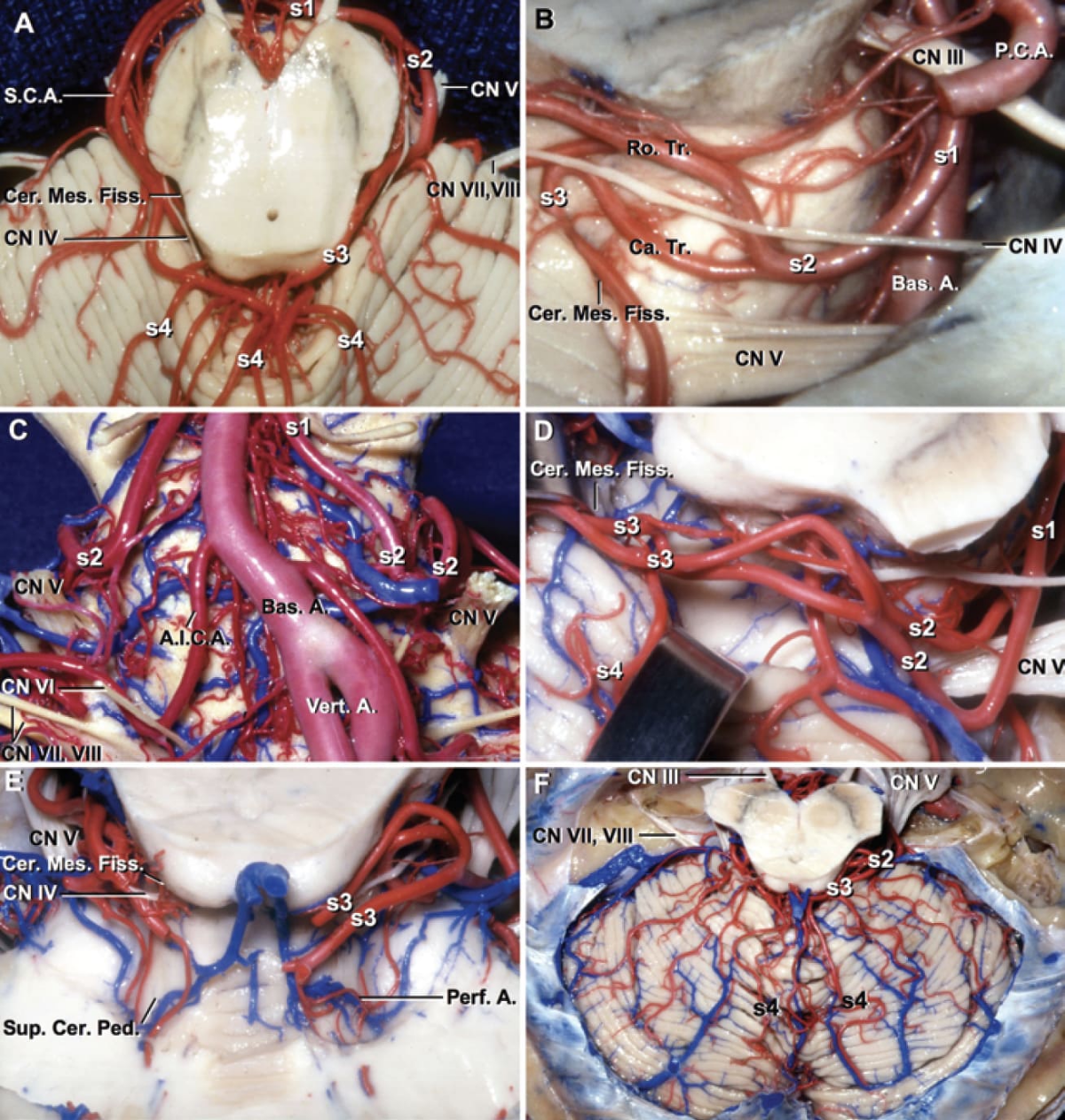 Segments of the SCA | Neuroanatomy | The Neurosurgical Atlas