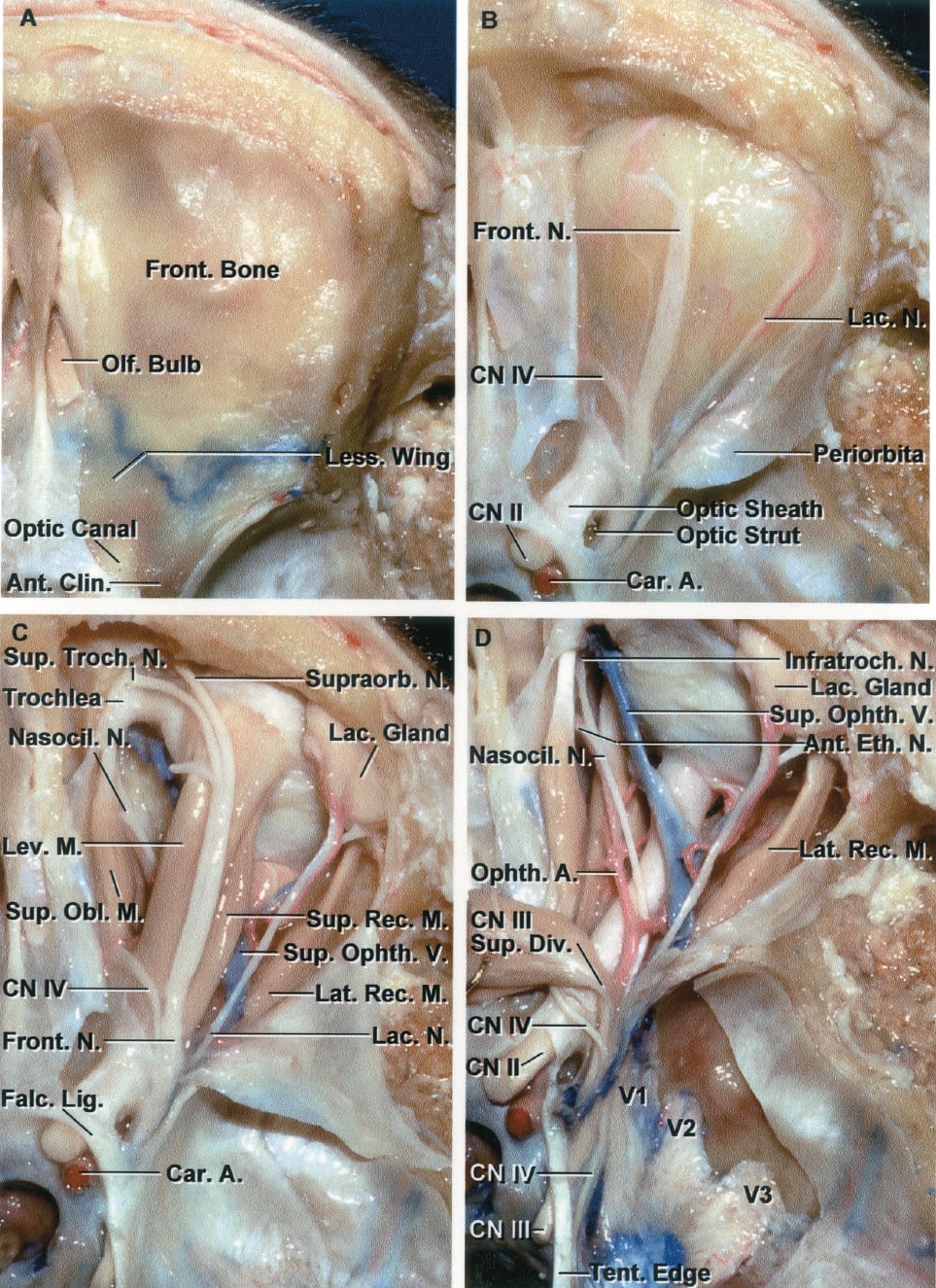 Superior View of a Stepwise Dissection of the Neural Structures in the ...
