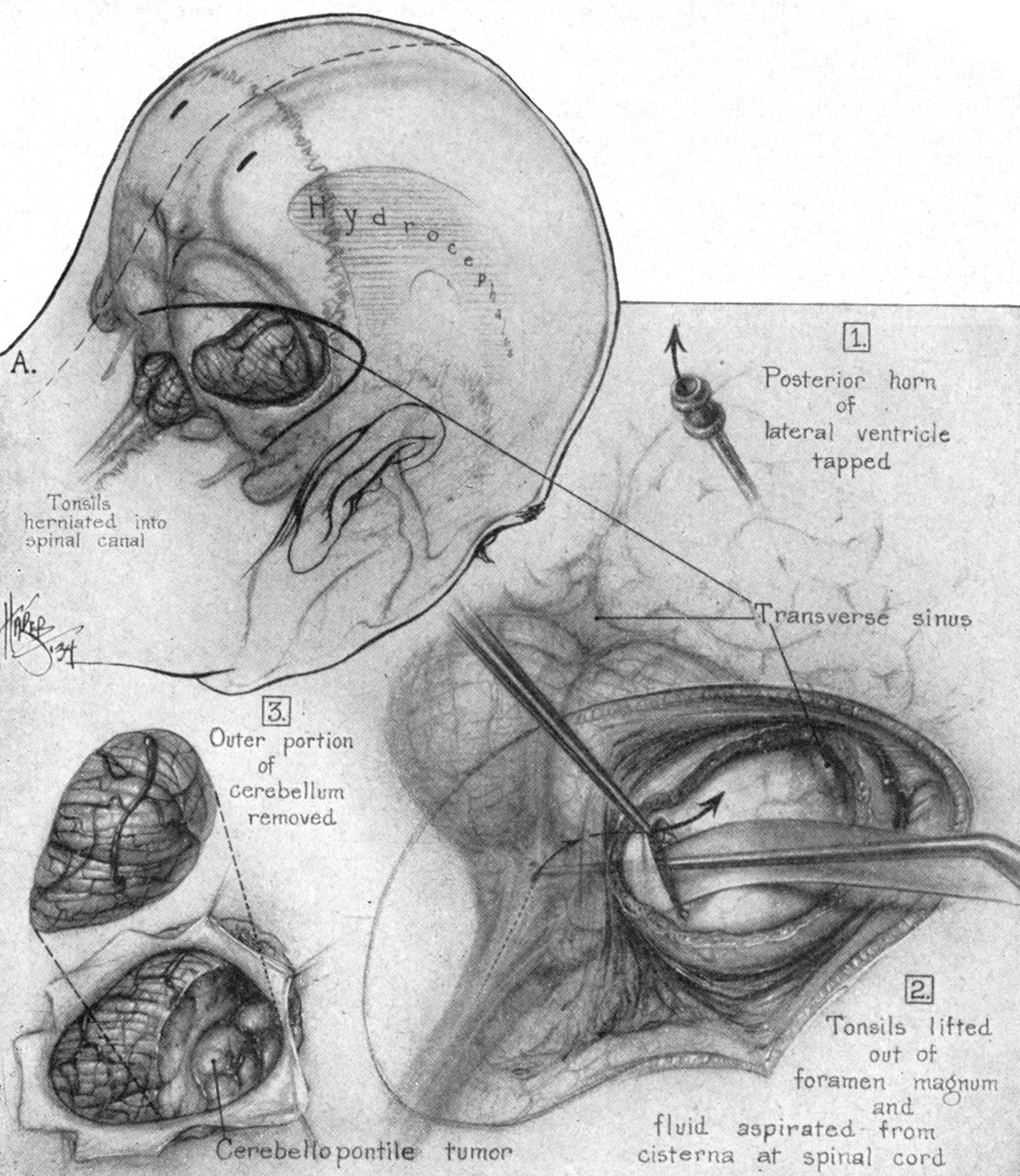 脳神経外科 Atlas of Cranial Base Surgery opengraph-image-egbhc6?