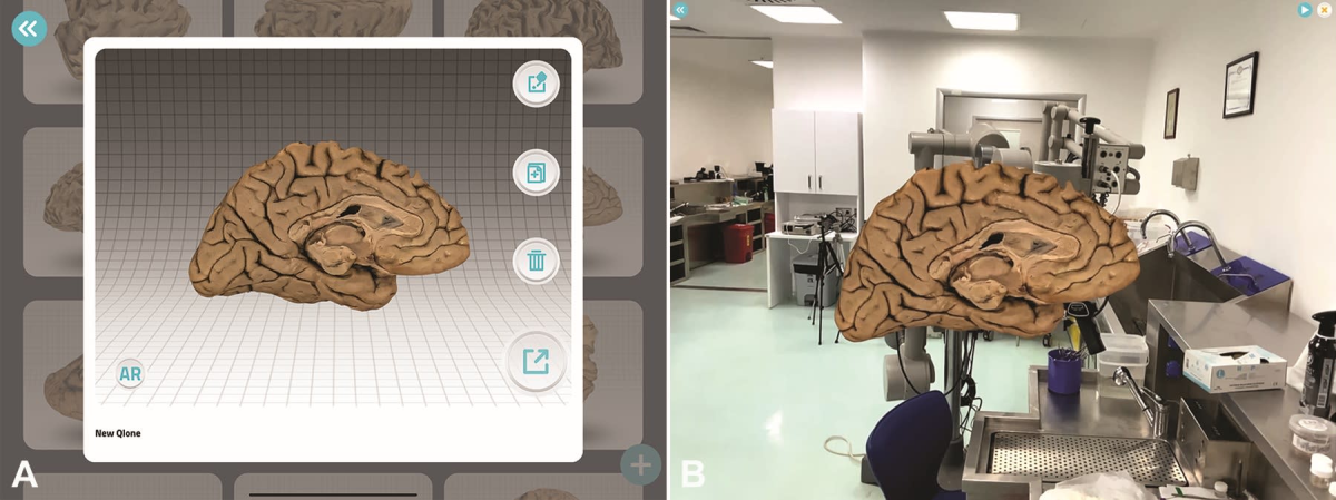 3D Simulations of the White Matter Anatomy of the Cerebrum | Cohen ...