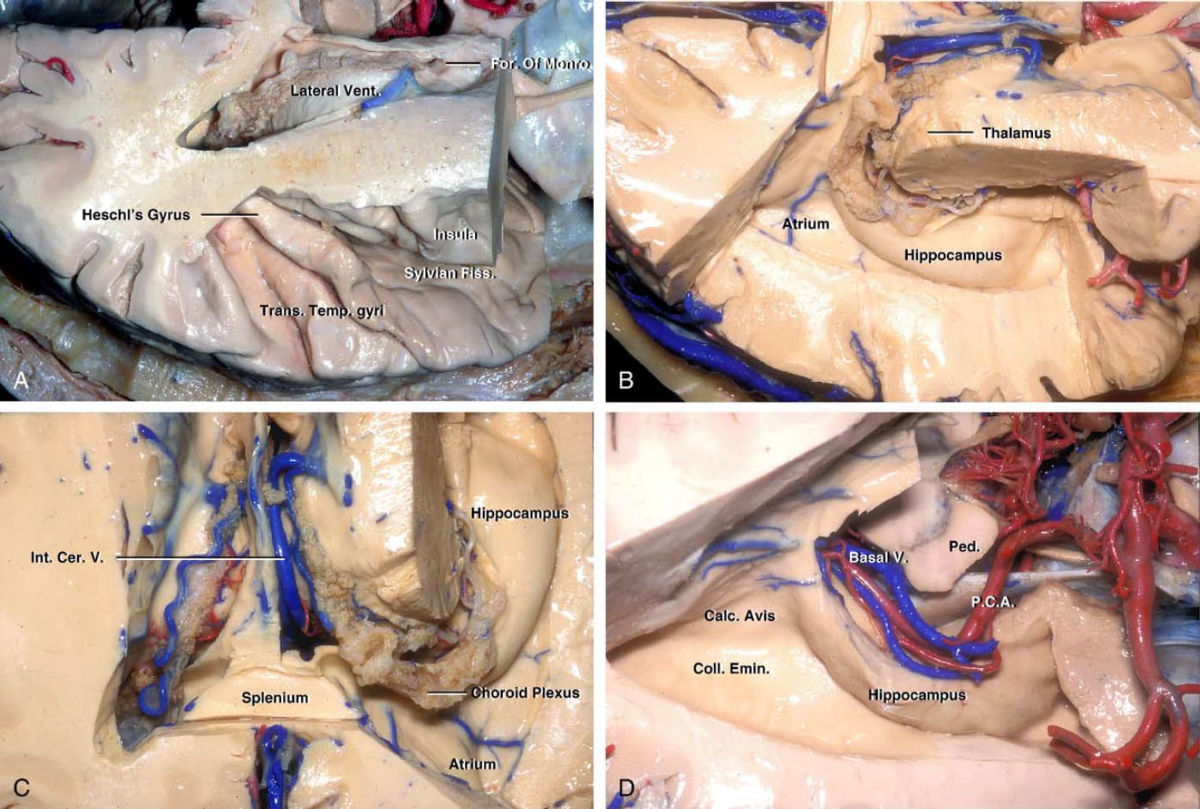 Atrium of the Lateral Ventricle | Cohen Collection | Volumes | The ...